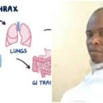 Veterinarian Identifies Solutions to Anthrax Infection – Radio Nigeria Progress FM